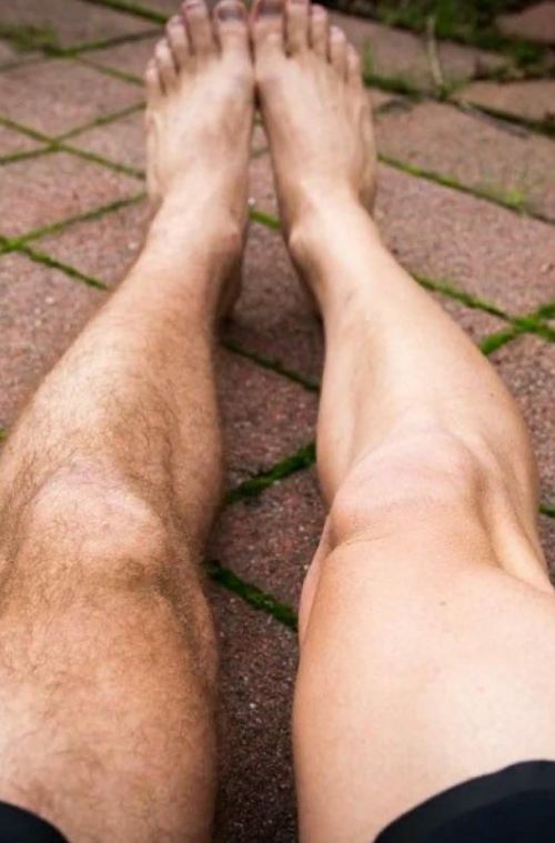 A man's waxed leg next to an unwaxed leg