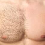 A man's half-waxed chest