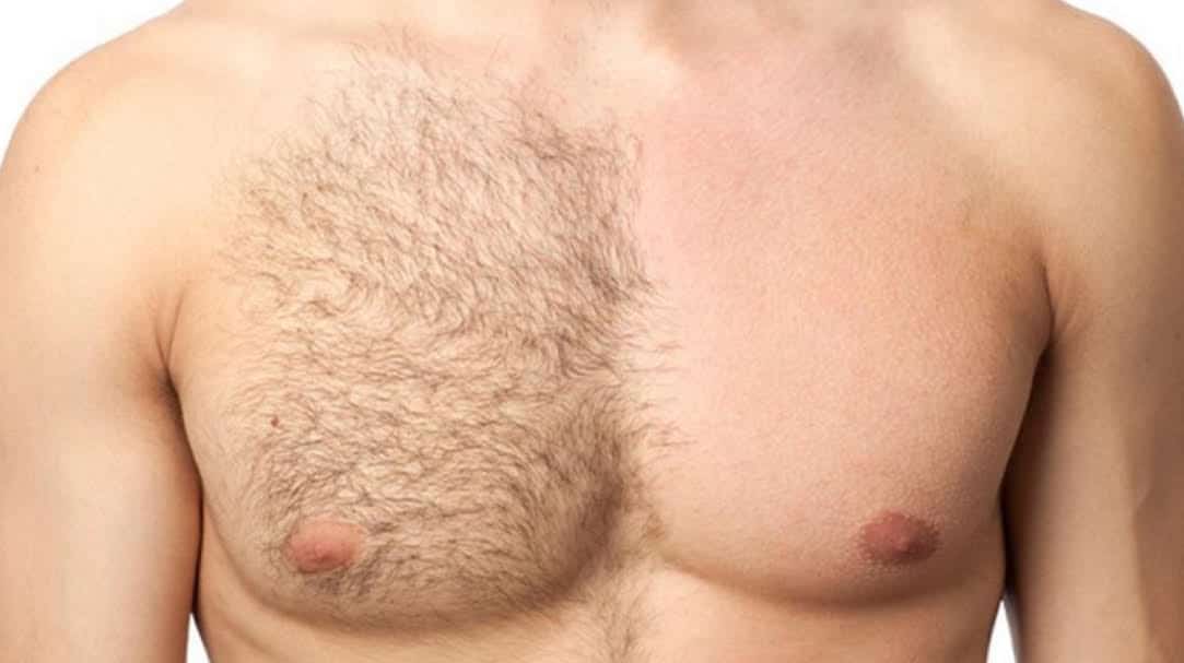 A man's half-waxed chest