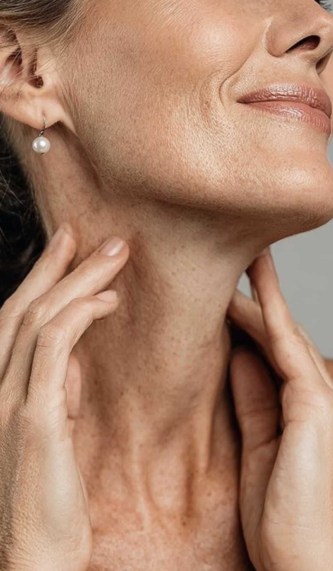 female chin and neck showing mature hormonal skin